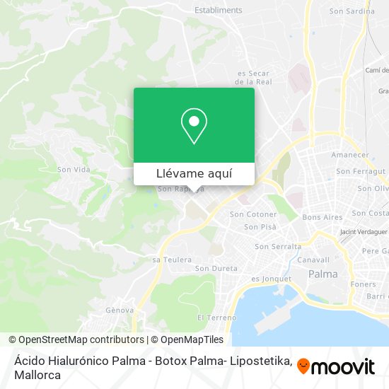 Mapa Ácido Hialurónico Palma - Botox Palma- Lipostetika