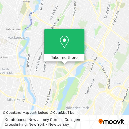 Keratoconus New Jersey Corneal Collagen Crosslinking map