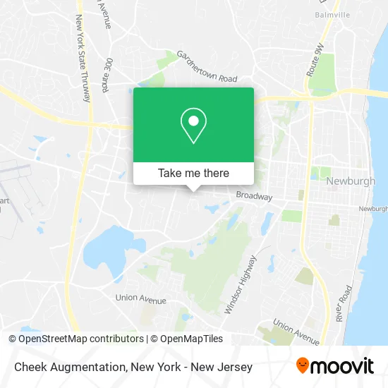 Cheek Augmentation map