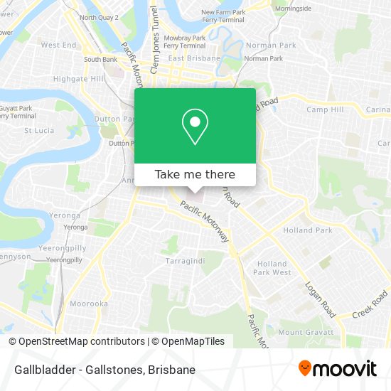 Gallbladder - Gallstones map