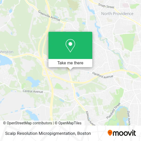 Scalp Resolution Micropigmentation map