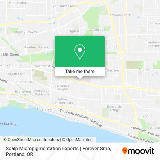 Scalp Micropigmentation Experts | Forever Smp map