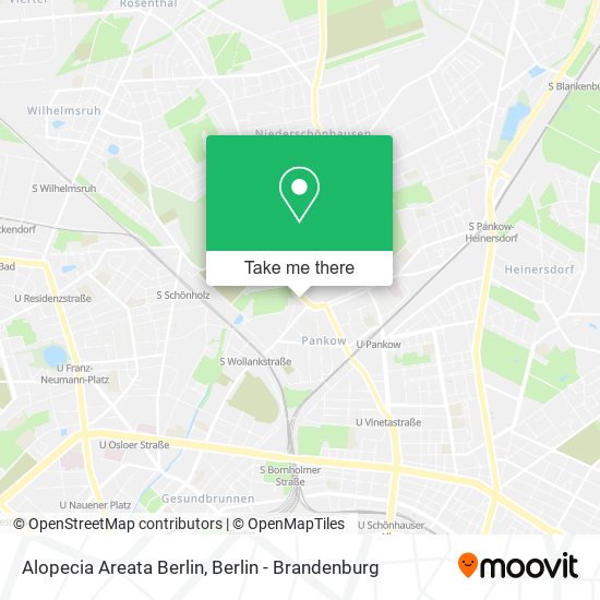 Alopecia Areata Berlin map