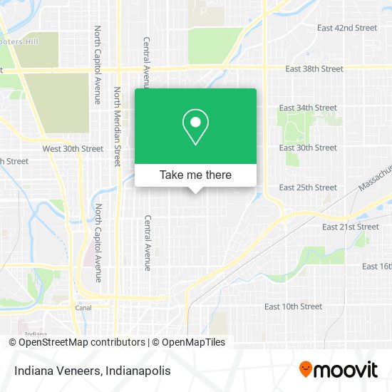 Indiana Veneers map