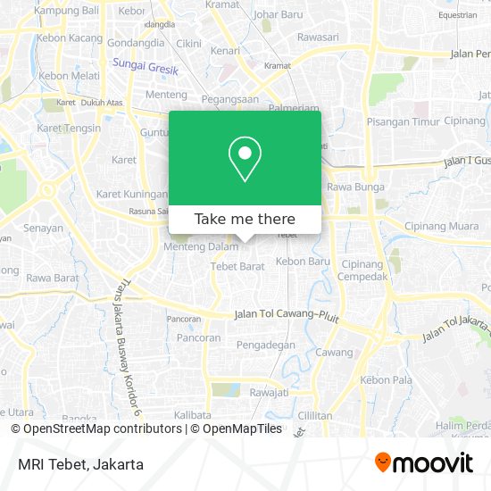 MRI Tebet map