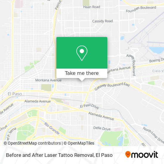 Before and After Laser Tattoo Removal map