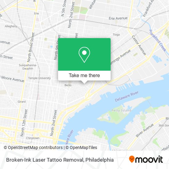 Broken-Ink Laser Tattoo Removal map