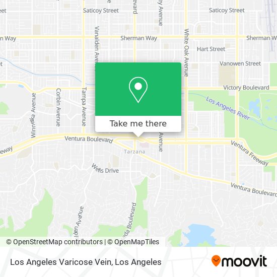 Los Angeles Varicose Vein map