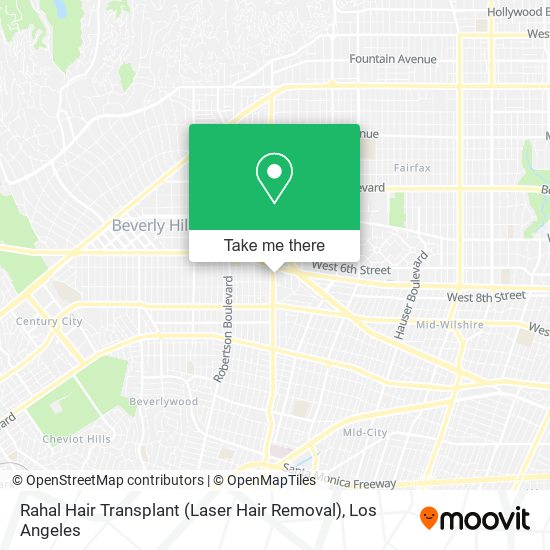 Rahal Hair Transplant (Laser Hair Removal) map
