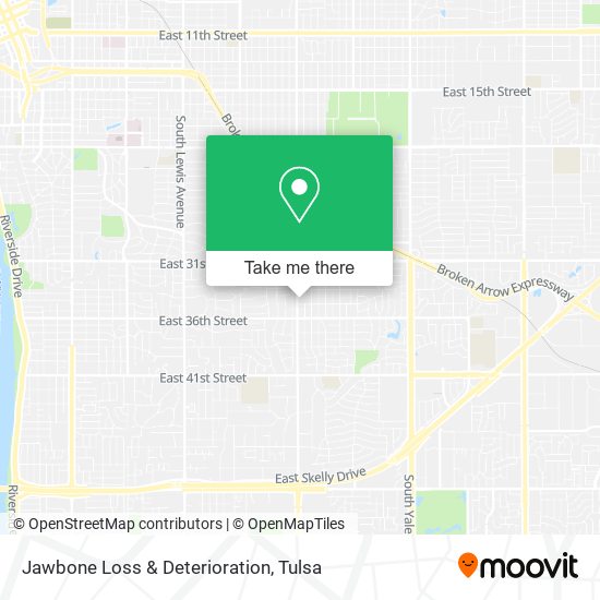 Jawbone Loss & Deterioration map