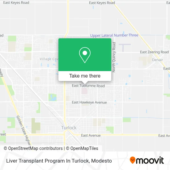 Liver Transplant Program In Turlock map