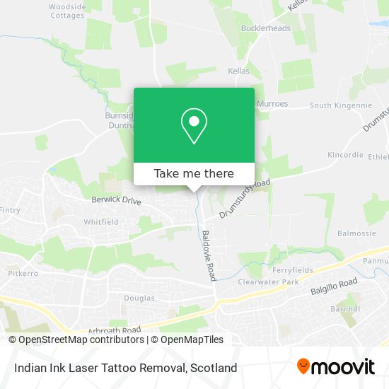 Indian Ink Laser Tattoo Removal map