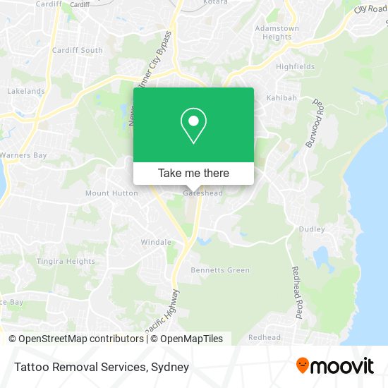 Tattoo Removal Services map