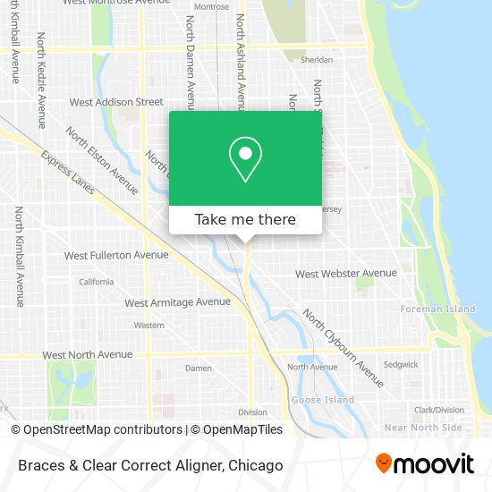 Braces & Clear Correct Aligner map