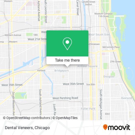 Mapa de Dental Veneers