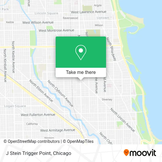 J Stein Trigger Point map
