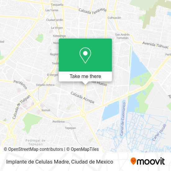 Implante de Celulas Madre map